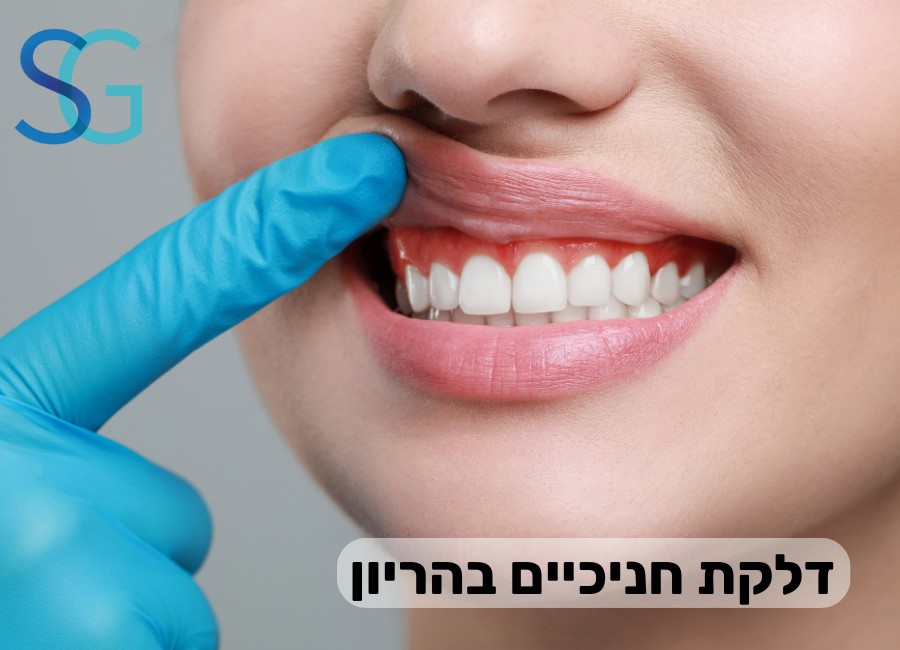 דלקת חניכיים בהריון